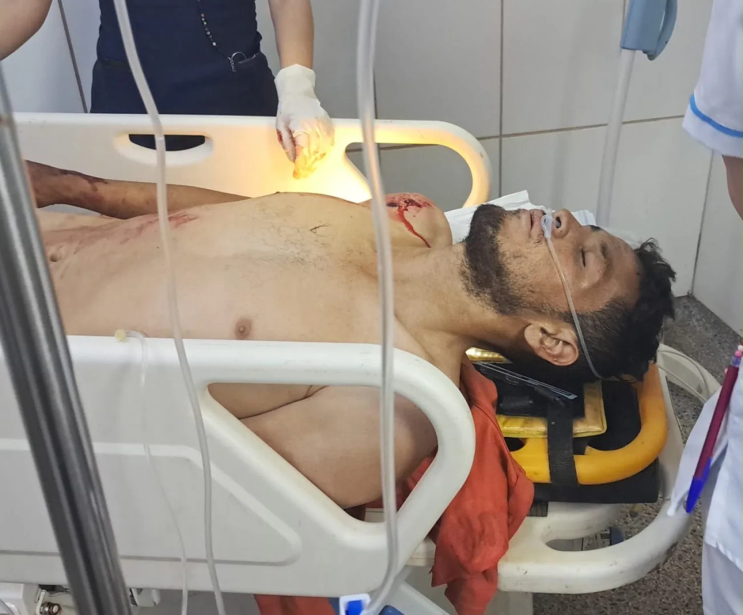 Tentativa de homicidio en la colonia Potrero Sur