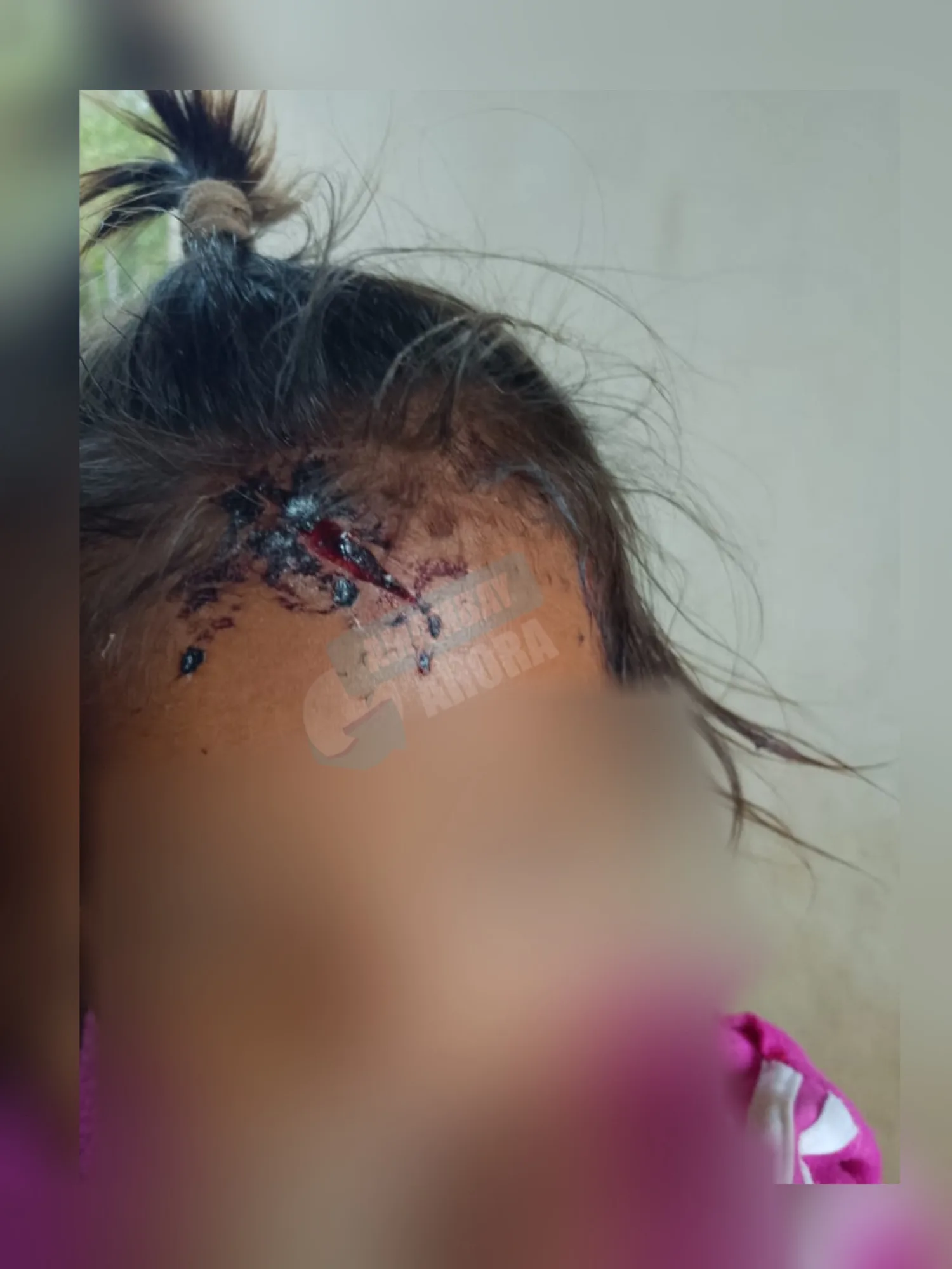 Aprehenden a un hombre por agredir a su hija de un año en el distrito de Cerro Corá