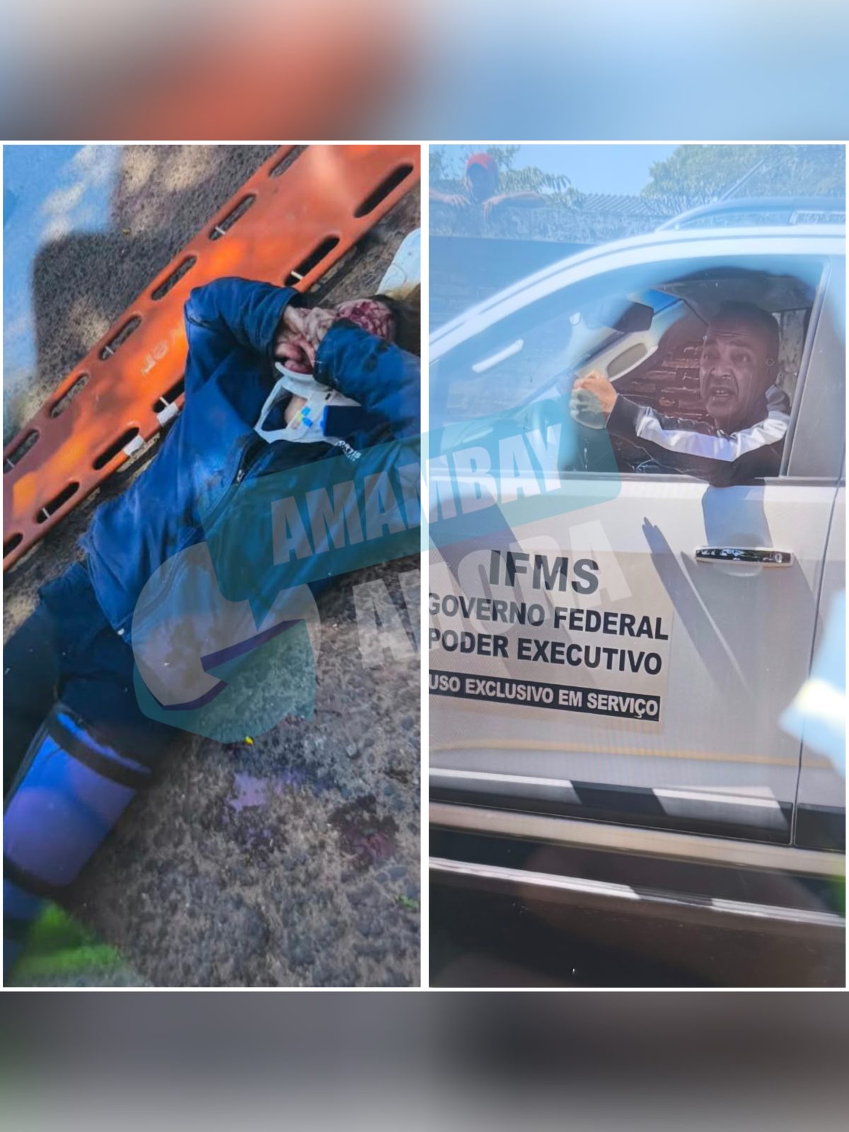 Buscan a un conductor que atropelló y fracturó a una joven en Pedro Juan Caballero