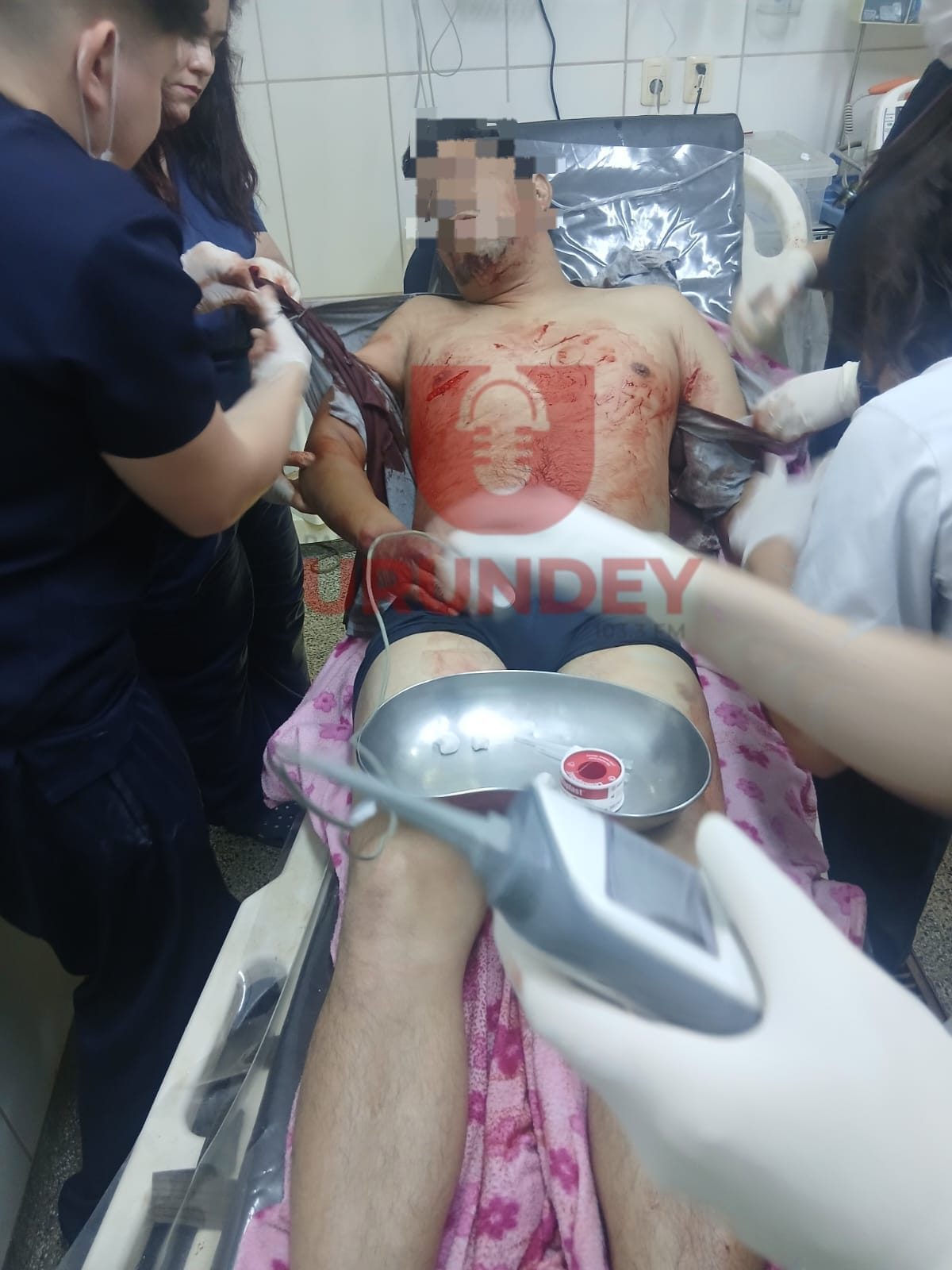 Un hombre atacó a puñaladas al acompañante de su expareja